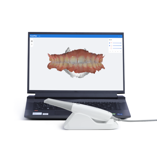 Fussen - S6500 Intraoral Scanner